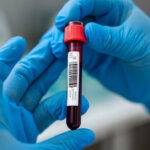 WHO Warns as E-Cigarette Use Rises Among Youth