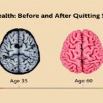 Apricots: The Sweet Natural Cure for Low Iron and Fatigue