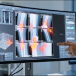 Apple’s Limited Edition MagSafe Grip Boosts Accessibility for Users With Disabilities