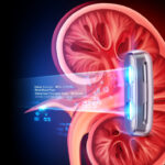 AI Predicts Future Arthritis Damage With Advanced X-ray Modeling