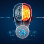 mRNA COVID Vaccines Could Supercharge Cancer Treatments