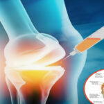 Hidden Nasal Fungi Worsen Allergies and Asthma