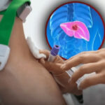 Prediabetes Can Be Reversed Naturally Within 2 Years, Study Shows