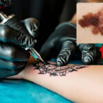 High Blood Pressure Control Worsens in England