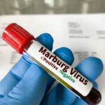 Eating More Vitamin C Directly Boosts Collagen and Skin Renewal, Study Finds