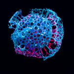 Hidden Fire Crisis Fuels Bigger Wildfires Across the Western U.S.