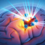 High Red Meat Intake Raises Diabetes Risk