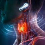 GLP-1 Drugs May Improve Heart Attack Recovery