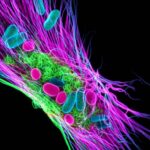 Hidden Genetic Cause of Diabetes in Babies Uncovered